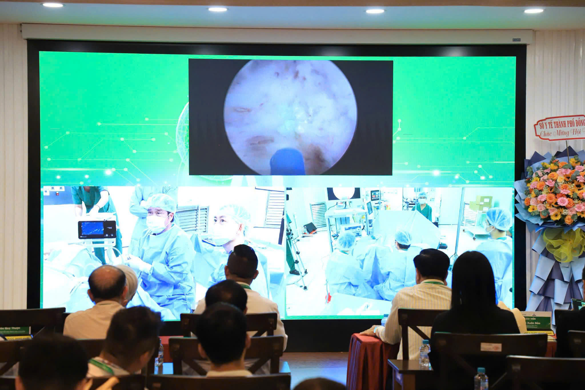 Cập nhật công nghệ Laser, AI trong điều trị bệnh lý tiết niệu